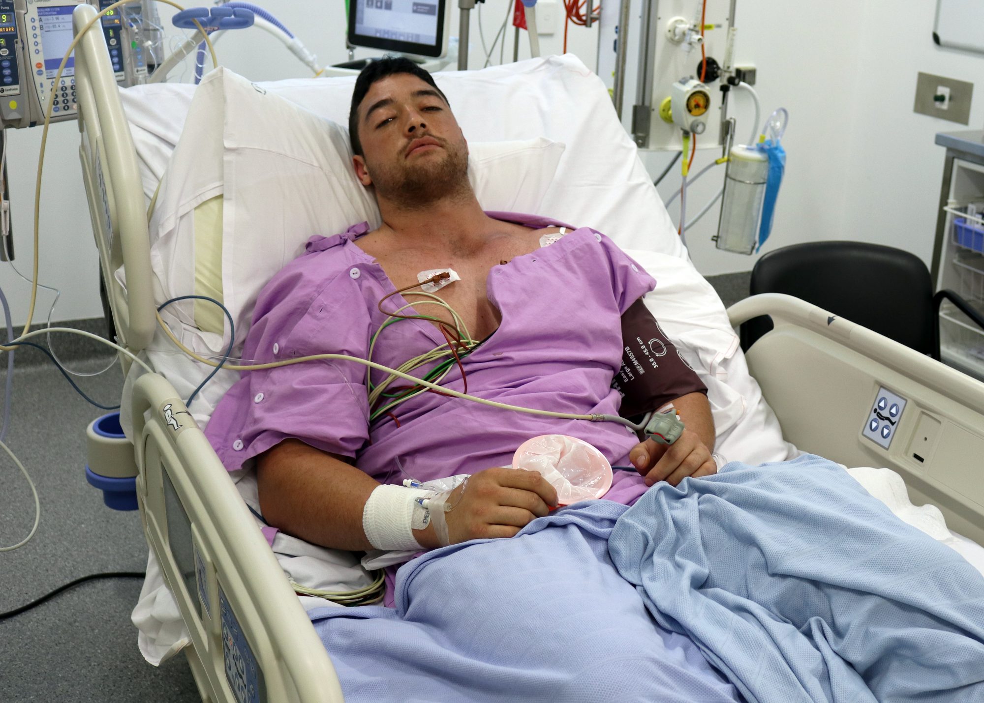 Moranbah Man Survives Deadly Snake Bite - Mackay Hospital And Health ...